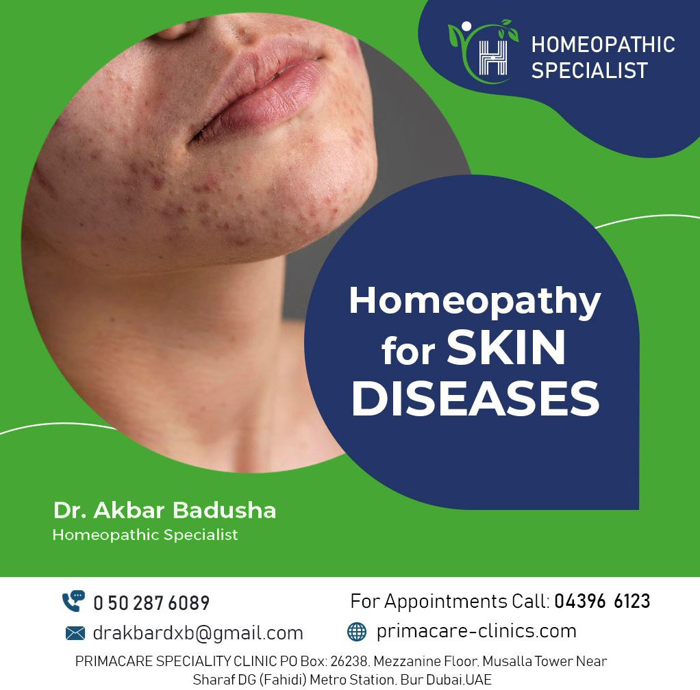 akbars  homeopathy